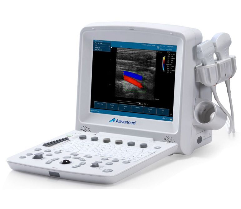MÁY SIÊU ÂM DOPPLER MÀU DUS-5000